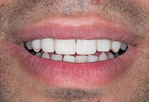 dental images 11557