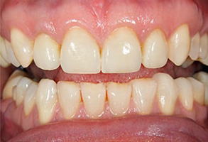 East Rockaway dental images