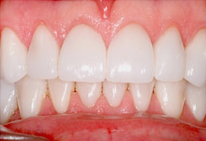 East Rockaway dental images