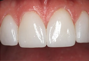 East Rockaway dental images