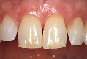 Hewlett dental images